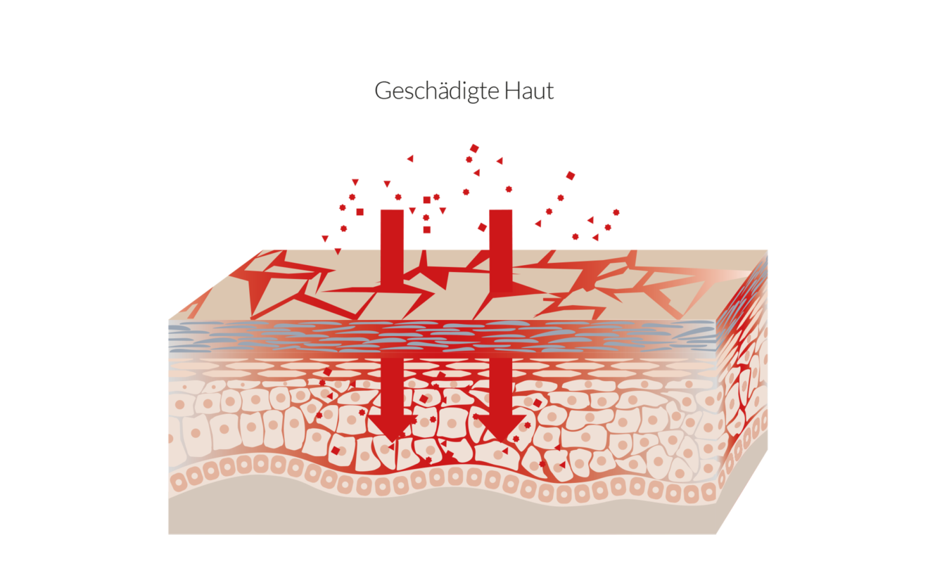 bebomed Geschaedigte Haut Illustration